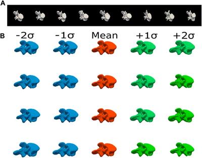 Spine and Individual Vertebrae Segmentation in Computed Tomography Images Using Geometric Flows and Shape Priors